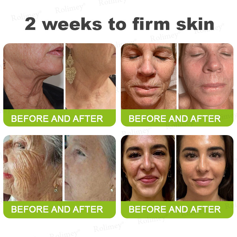 ☀️Made and shipped from the UK 💫Rolimey® Botox & Vita-A Retinol Shot Wrinkle-Lift Tightening cream - Last Day Promotion 70% OFF