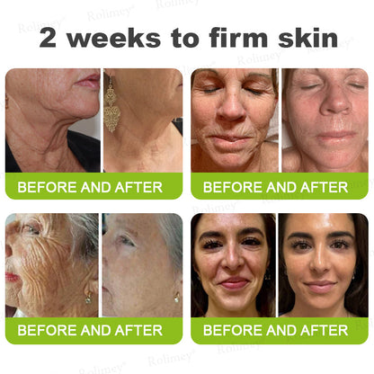 ☀️Made and shipped from the UK 💫Rolimey® Botox & Vita-A Retinol Shot Wrinkle-Lift Tightening cream - Last Day Promotion 70% OFF