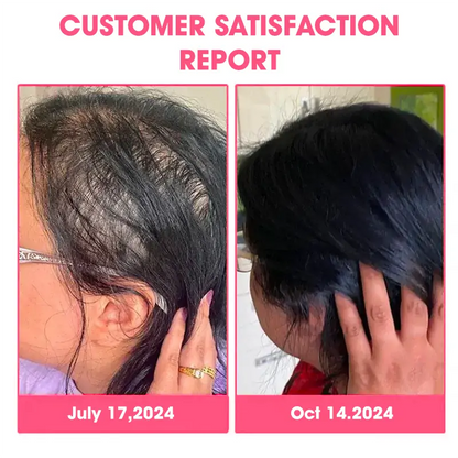 🫧DeeVoo™ Luxe Bee Venom Scalp Treatment HairGrᴏᴡth Hair Spray(Hurry! 80% OFF - Only 30 minutes left 🫧)