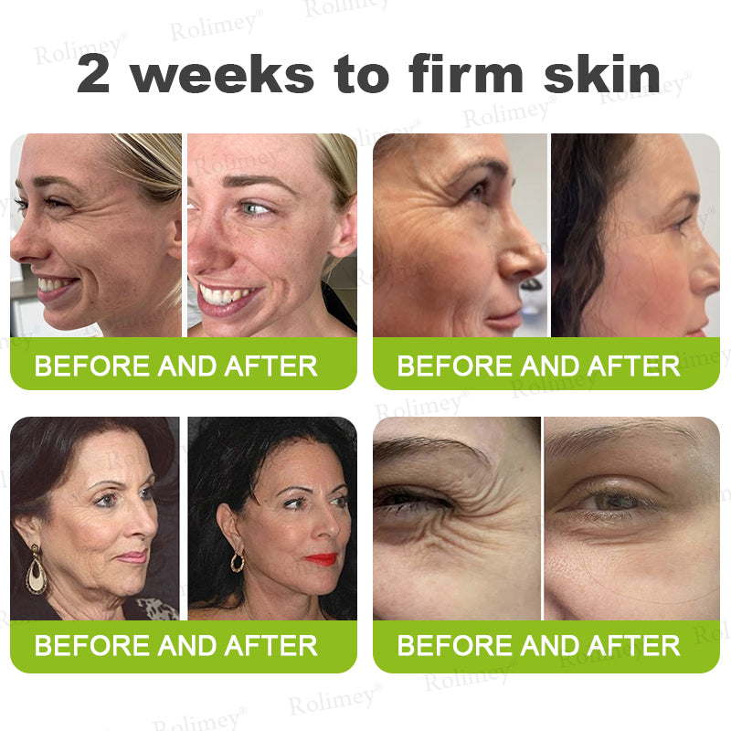 ☀️Made and shipped from the UK 💫Rolimey® Botox & Vita-A Retinol Shot Wrinkle-Lift Tightening cream - Last Day Promotion 70% OFF