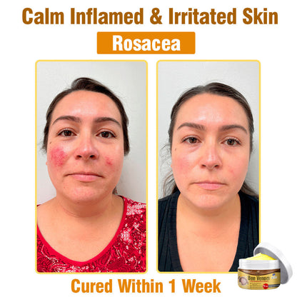 🎉(🔥🏆Made and Shipped from USA✅) flysmus™ Bee Venom Comprehensive Cream- LAST DAY 70% OFF
