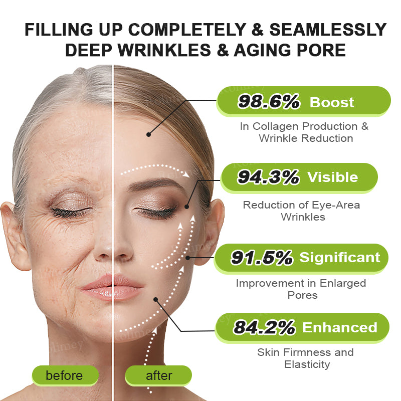 ☀️Made and shipped from the UK 💫Rolimey® Botox & Vita-A Retinol Shot Wrinkle-Lift Tightening cream - Last Day Promotion 70% OFF
