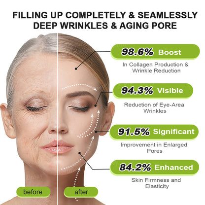 ☀️Made and shipped from the UK 💫Rolimey® Botox & Vita-A Retinol Shot Wrinkle-Lift Tightening cream - Last Day Promotion 70% OFF