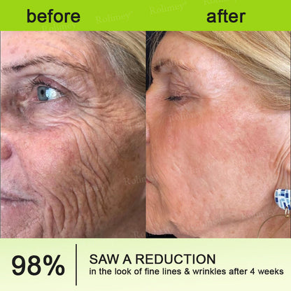 ☀️Made and shipped from the UK 💫Rolimey® Botox & Vita-A Retinol Shot Wrinkle-Lift Tightening cream - Last Day Promotion 70% OFF