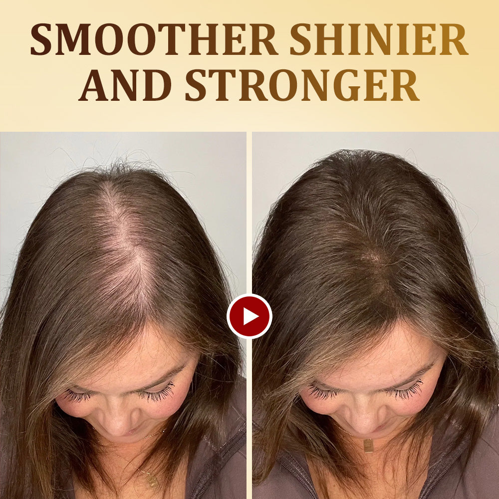 👨‍⚕️🪄US FDA APPROVED | Furzero™ Ginger Infused Collagen Repair Conditioner🌟