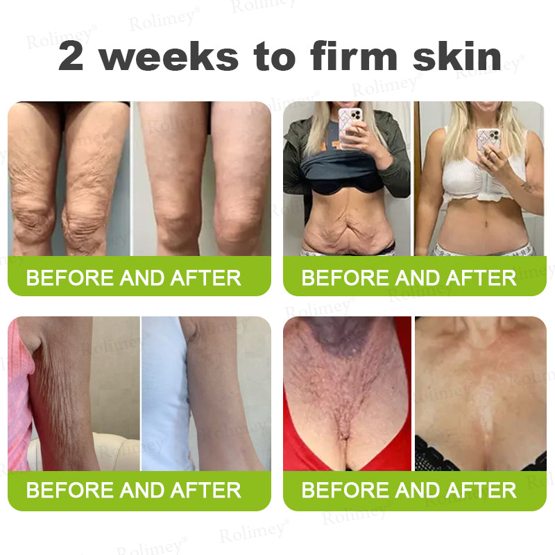 ☀️Made and shipped from the UK 💫Rolimey® Botox & Vita-A Retinol Shot Wrinkle-Lift Tightening cream - Last Day Promotion 70% OFF