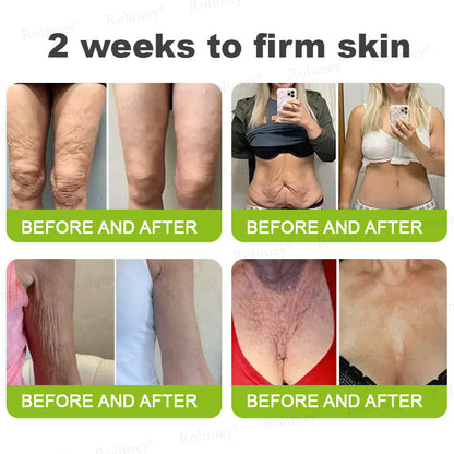 ☀️Made and shipped from the UK 💫Rolimey® Botox & Vita-A Retinol Shot Wrinkle-Lift Tightening cream - Last Day Promotion 70% OFF
