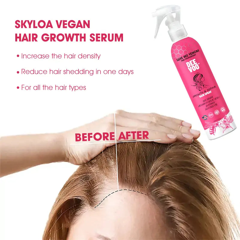 🫧DeeVoo™ Luxe Bee Venom Scalp Treatment HairGrᴏᴡth Hair Spray(Hurry! 80% OFF - Only 30 minutes left 🫧)