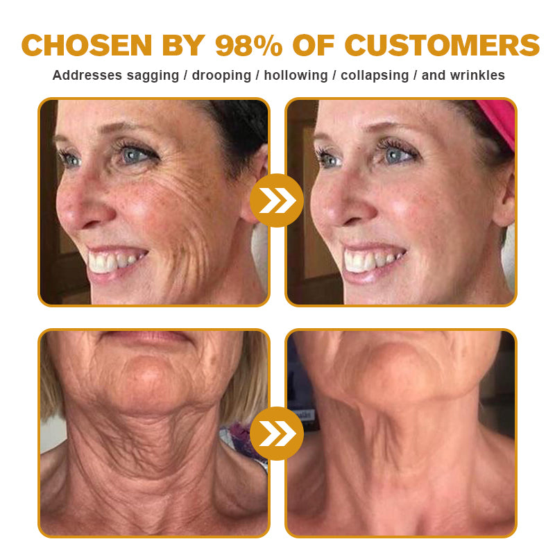(🔥🌸Made and Shipped from USA✅) Furzero™ Botox Bee Venom Wrinkle Removal Cream- LAST DAY 70% OFF