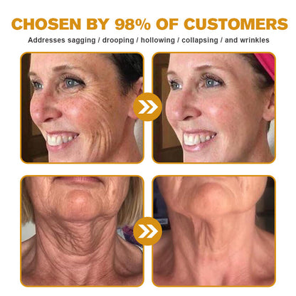 (🔥🌸Made and Shipped from USA✅) Furzero™ Botox Bee Venom Wrinkle Removal Cream- LAST DAY 70% OFF