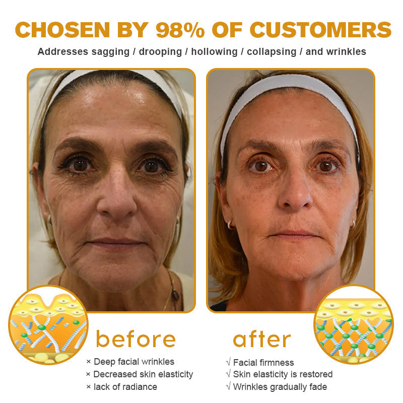 (🔥🌸Made and Shipped from USA✅) Furzero™ Botox Bee Venom Wrinkle Removal Cream- LAST DAY 70% OFF
