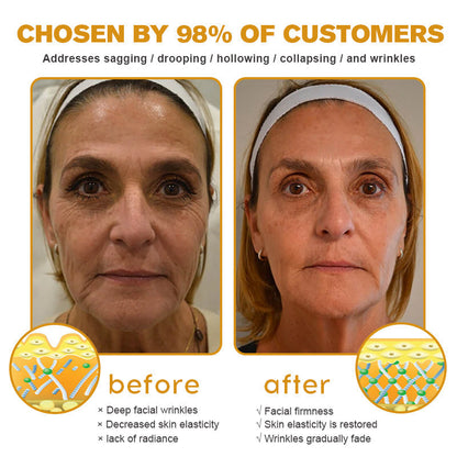 (🔥🌸Made and Shipped from USA✅) Furzero™ Botox Bee Venom Wrinkle Removal Cream- LAST DAY 70% OFF